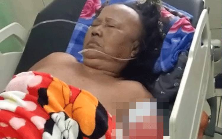 Nenek Bahriah (74) putus?tangannya setelah disambar buaya.