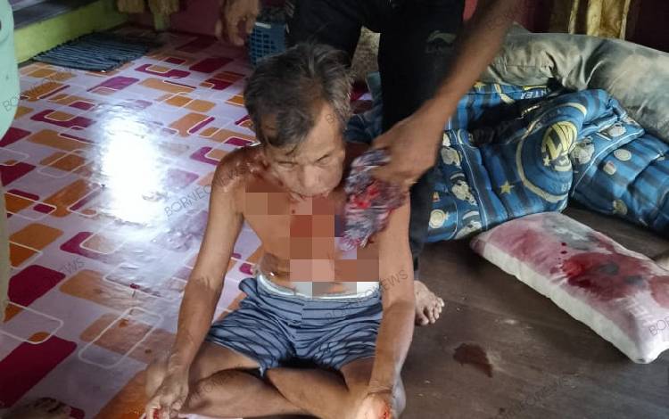 Korban Dawon Jidan (65) korban penganiaao?oleh Dipo. (FOTO: IST)