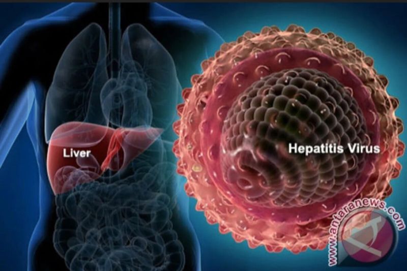 Ilustrasi - Penyakit Hepatitis B. ANTARA/HO