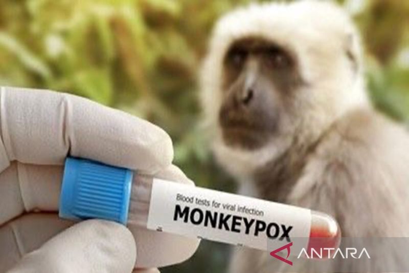 Ilustrasi - penyakit cacar monyet. (FOTO.ANTARA-HO/IST/hmskominfokalsel)