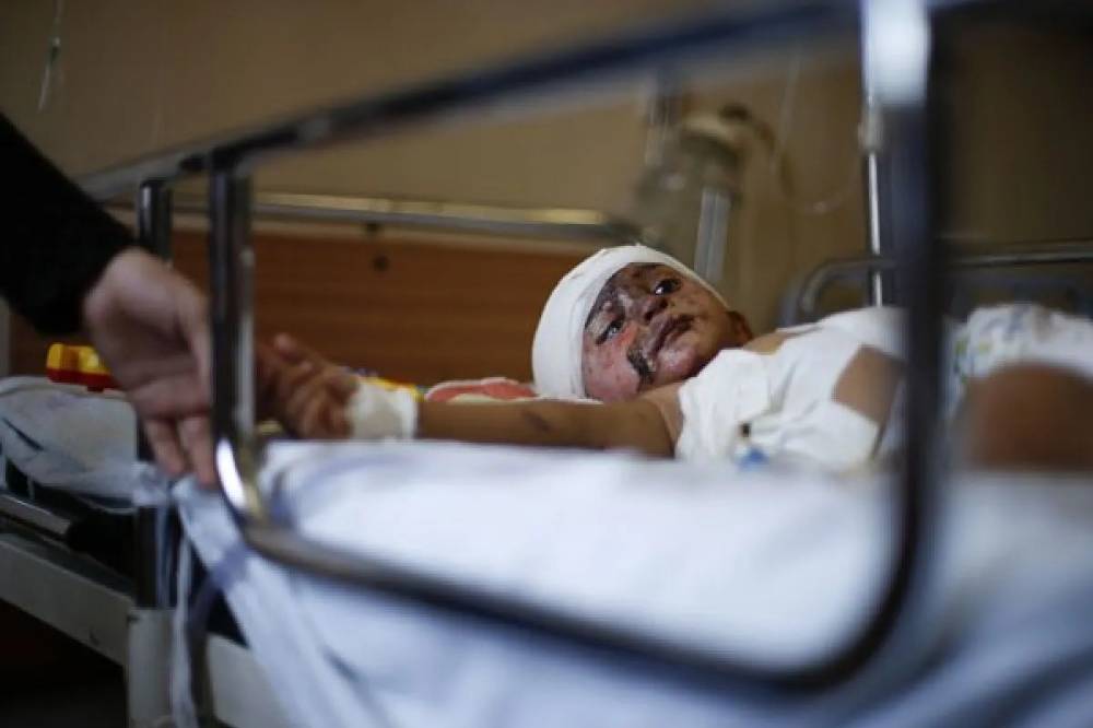 Bocah lelaki Palestina 1,5 tahun Mohamed Wahdan, menurut medik terluka dalam serangan udara Israel, terbaring di tempat tidur dan menerima perawatan di rumah sakit di Gaza, Rabu (6/8). Angka yang dikeluarkan hari Rabu oleh UNICEF, perwakilan PBB untuk anak-anak, menunjukkan 419 anak-anak Palestina tewas dalam perang di Gaza selama sebulan. Hal tersebut berbanding dengan 350 anak dalam serangan Israel selama tiga minggu di wilayah itu lima tahun lalu. Setidaknya enam anak-anak Israel terluka akib