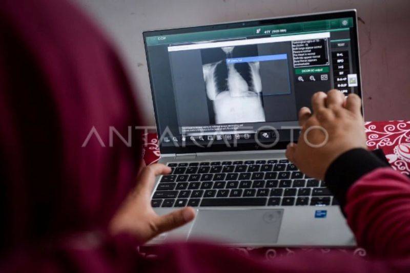 Tenaga kesehatan melihat hasil skrining rontgen thorax seorang warga di Puskesmas Cibodasari, Kota Tangerang, Banten, Selasa (11/11/2025). Kementerian Kesehatan berencana memperluas program layanan skrining terpadu yang telah berjalan di delapan puskesmas menjadi diperluas sebanyak 100 puskesmas di delapan provinsi pada tahun 2026 untuk mengidentifikasi secara dini penderita tuberkulosis (TBC) guna mencegah penyebaran penyakit tersebut. ANTARA FOTO/Putra M. Akbar/tom
