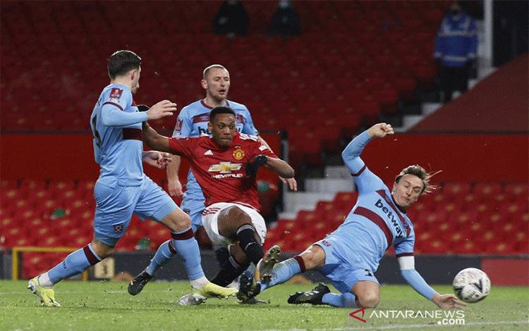 Penyerang MU Anthony Martial Akan Jalani Pemindaian Pinggul