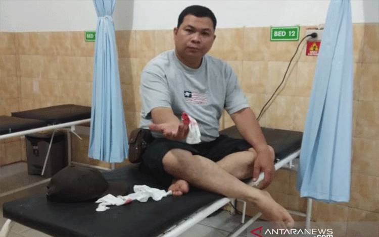 Polisi Tangkap Penganiaya Wartawan, Jari Korban Putus Digigit Pelaku