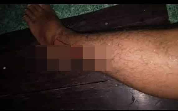 Serangan Buaya Mengganas, Giliran Warga Cempaga Jadi Korban