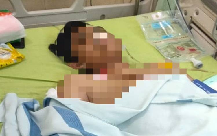 Korban Tabrak Truk CPO Masih Kritis