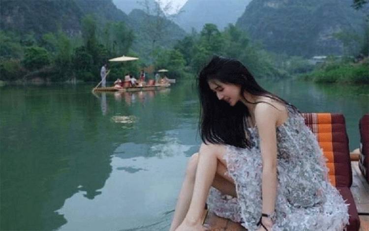 Pesohor Medsos China Meninggal Usai Operasi Plastik