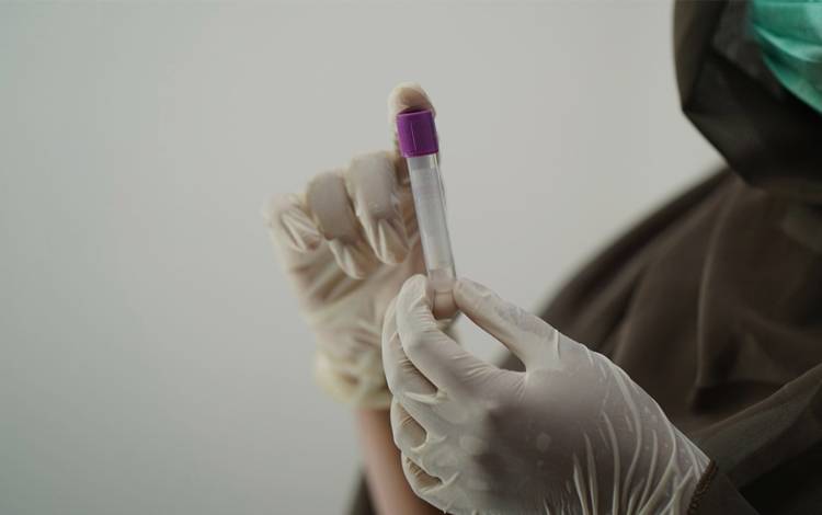 RSUD Kota Palangka Raya Buka Lowongan Analis Kesehatan