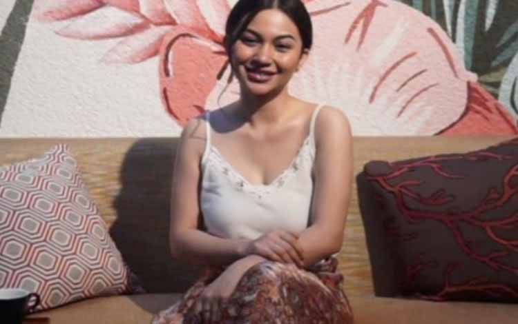 Cerita Ariel Tatum Jadi Korban Skin Care karena Terhasut Teman