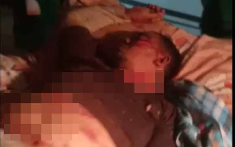 Diserang Buaya, Staf Lapangan TNTP Resor Sungai Perlu Alami Luka Serius