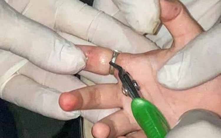 Bocah di Kelurahan Ketapang Ini Tiba-Tiba Kesakitan Jarinya Membengkak