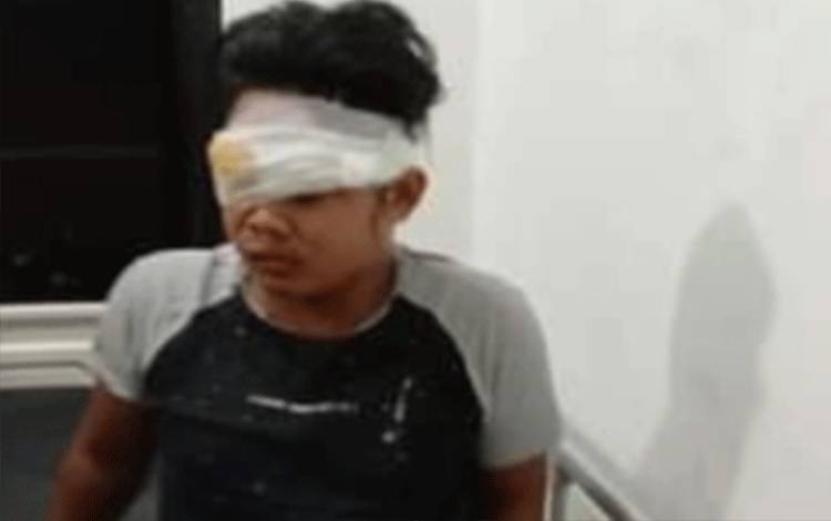 Pengendara Vixion Alami Luka Serius Setelah Jadi Korban Tabrak Lari Mobil Berpelat Merah