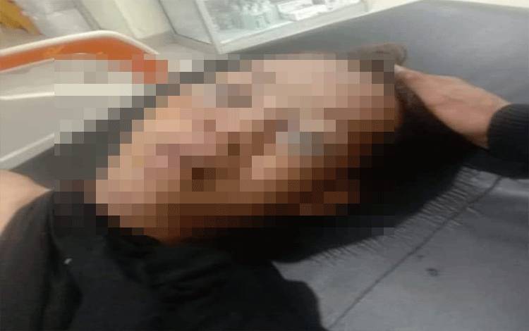 Korban Tabrak Lari Dilarikan ke Palangka Raya