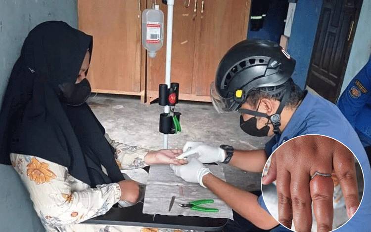 Jari Ibu ini Membengkak 3 Hari karena Cincin, Petugas Lakukan Pertolongan