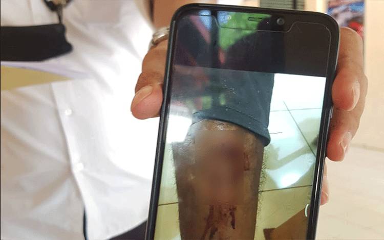Perampokan Bos Walet, Pelaku Tebas Korban dan Bawa Kabur Uang Ratusan Juta