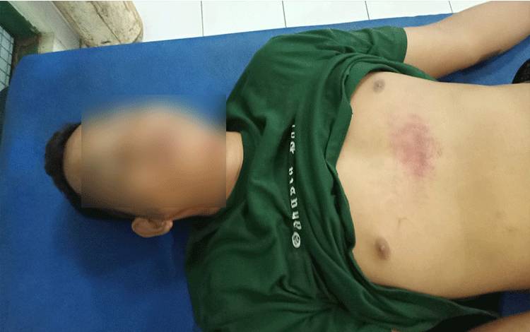 Pengendara Motor Tanpa Indentitas Alami Kecelakaan Tunggal dan Tak Sadarkan Diri