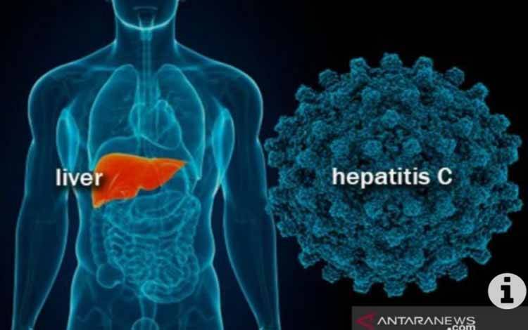 Biaya Perawatan Pasien Hepatitis Ditanggung BPJS Kesehatan