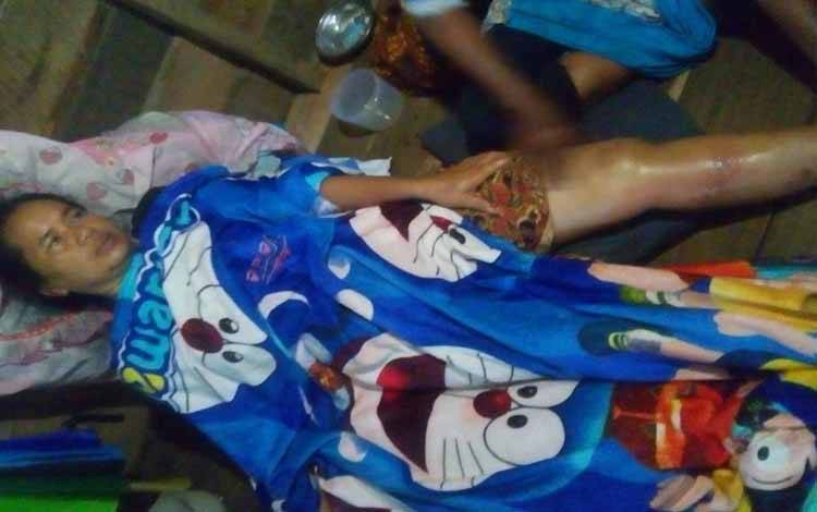 Perempuan di MHU Ini Berhasil Selamat dari Sambaran Buaya Meski Sempat Ditarik ke Sungai