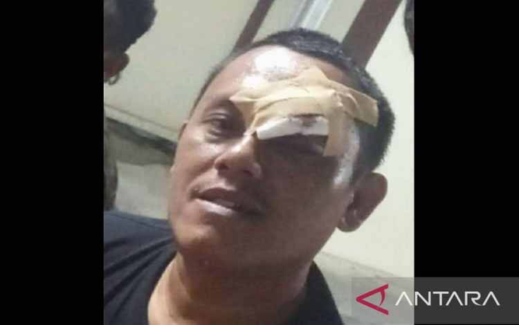 Polisi Usut Penculikan dan Penganiayaan Wartawan