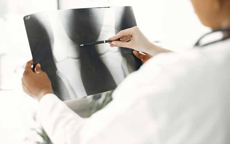 Malas Gerak Bisa Sebabkan Osteoporosis