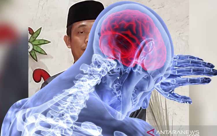 Faktor Waktu Sangat Penting untuk Penanganan Stroke
