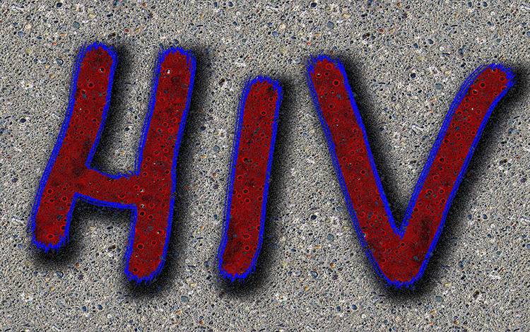 Ada 612 Kasus HIV di Kobar, di Antaranya Ibu Hamil dan Penyuka Sesama Jenis