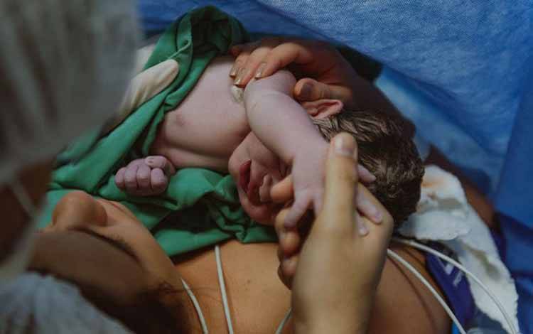 Dokter Jelaskan Tahapan Pemeriksaan Kesehatan Bayi Baru Lahir