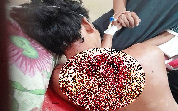 Ayah di Lamandau Tega Bacok Anak Tirinya Akibat Tersinggung Saat Minum Miras Bersama