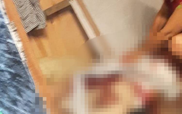 Seorang Pria jadi Korban Penusukan Orang Tidak Dikenal