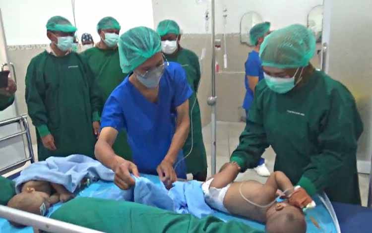 Operasi Bibir Sumbing Gratis untuk Membantu Masyarakat Kurang Mampu