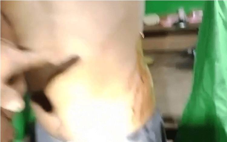 Video Viral Lelaki Luka Tembak, Ini Penjelasan Kapolres Kobar