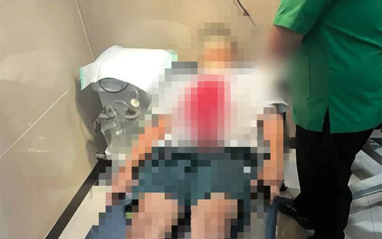 Driver Online di Palangka Raya Dikeroyok hingga Patah Tangan dan Luka-Luka di Kepala