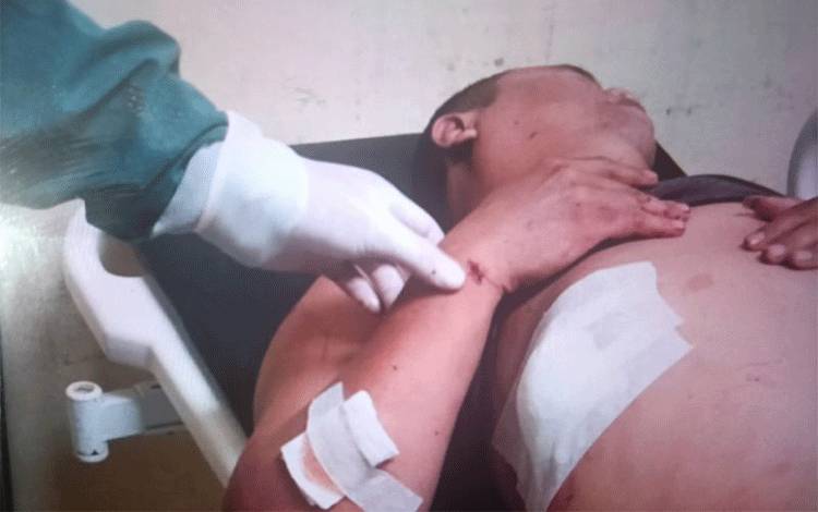 Polisi Tangkap Pelaku Penusukan