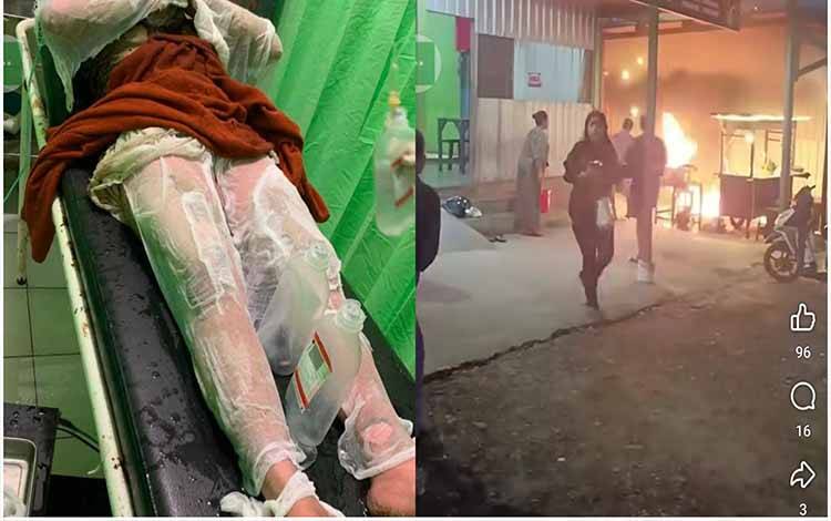 Pedagang Angkringan di Pangkalan Banteng Dibakar Mantan Suami Siri