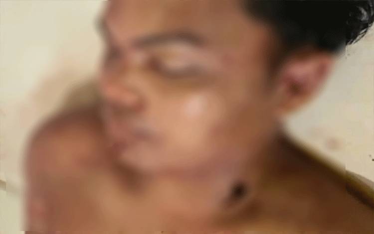 Perkelahian di Pesta Pernikahan Berujung Seorang Tewas dan Satu Kritis di Kuala Kuayan Kotim